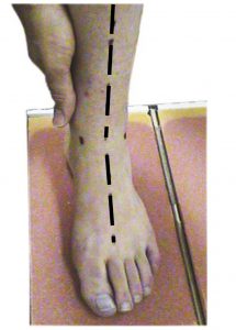 Neutral Foot Position