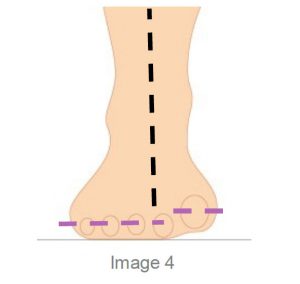 Foot measure for orthotics
