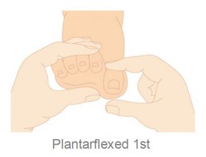 Plantarflexed 1s