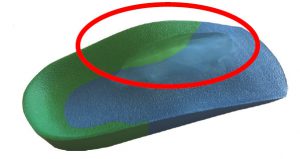 ICB Orthotic For Heel Pain